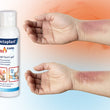 Detectaplast® Burn Care Gel – Effektive Soforthilfe bei Verbrennungen